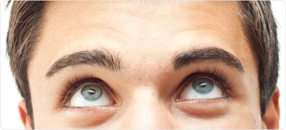 Eyelid surgery (Blepharoplasty) for men
